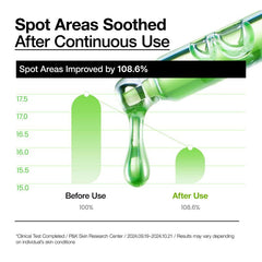 [Anua Official Shop] Spot Care Serum Duo TXA & Azelaic Acid | Azleaicacid, Niacinamide, Non-Poreclogging, Discoloration, Korean Skincare, Hyperpigmentation, Soothing